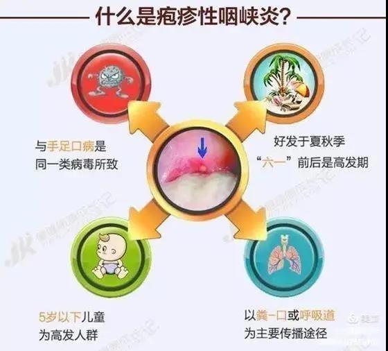 皰疹性咽峽炎及手足口病不用慌，紫外線燈來幫忙